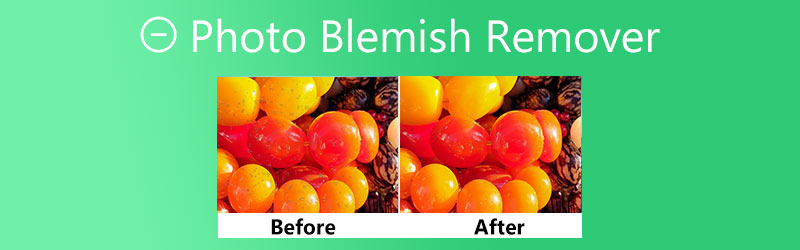 Photo Blemish Remover